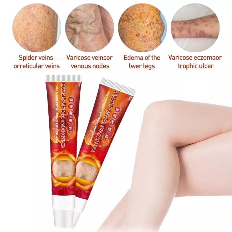 Varice 2 Veins Cream Pomada - Mundo Paraguayo
