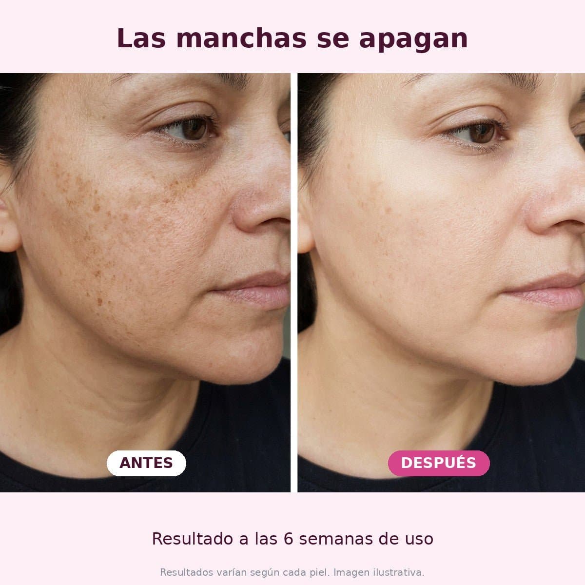99% PDRN Peptide + Collagen — Sérum Coreano con ADN de Salmón | Manchas y Luminosidad 30ml — 12