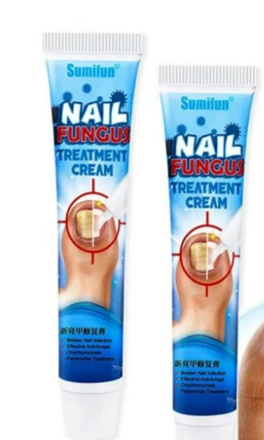 CREMA PARA EL TRATAMIENTO DE HONGOS EN LAS UÑAS - Mundo Paraguayo