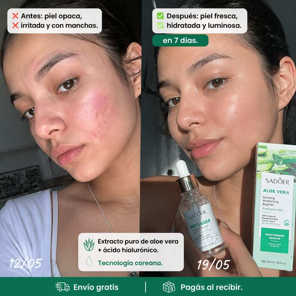 Serum Aloe Vera