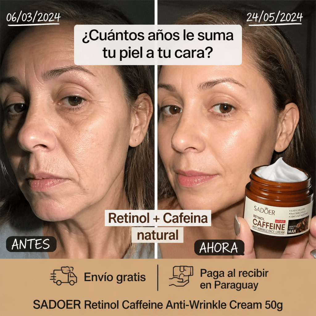 SADOER Retinol Caffeine Anti - Wrinkle Cream – Crema Antiedad con Retinol y Cafeína 50g - Mundo Paraguayo