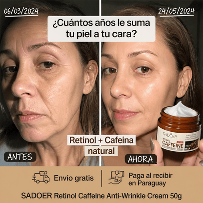SADOER Retinol Caffeine Anti - Wrinkle Cream – Crema Antiedad con Retinol y Cafeína 50g - Mundo Paraguayo