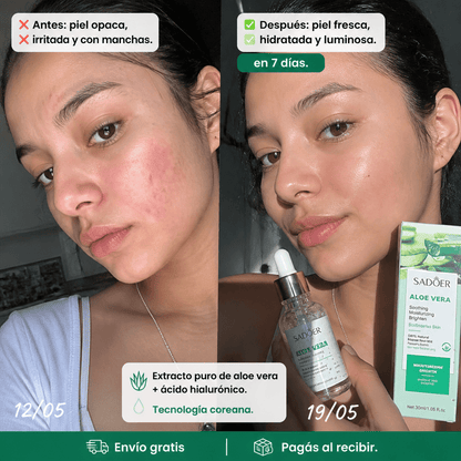 Sérum Facial de Aloe Vera - Mundo Paraguayo