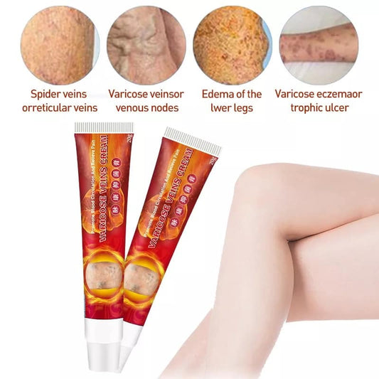 Varice 2 Veins Cream Pomada - Mundo Paraguayo